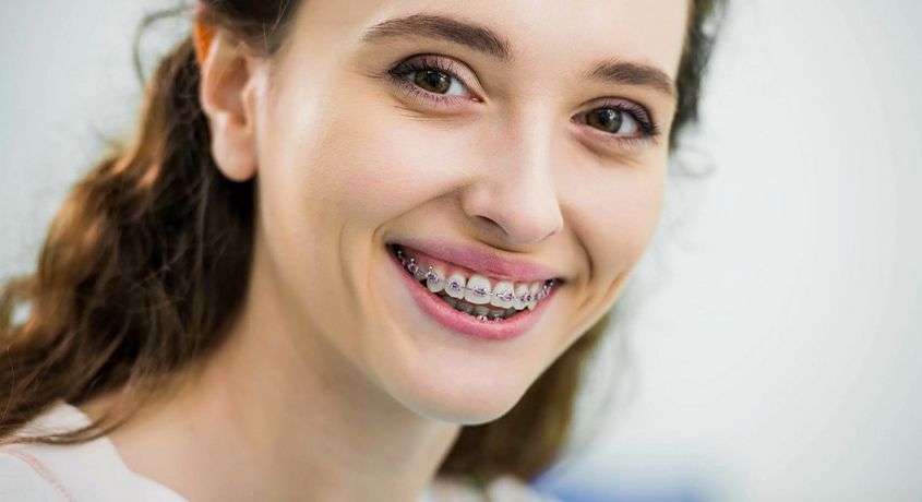 Идеальная улыбка по выгодной цене! Скидка 53% на брекеты + бесплатная установка от стоматологического центра «Улыбка».